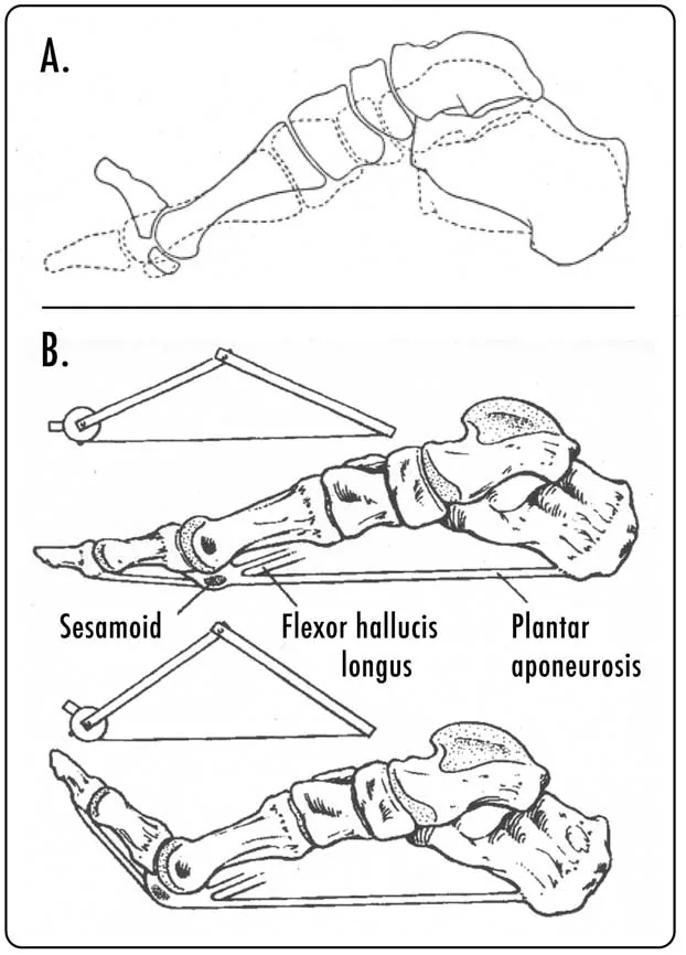 Ilustración de la fascia plantar del pie