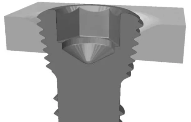 Esquema de un tornillo fijando una placa de osteosíntesis al hueso